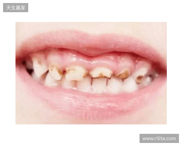 韦林顿确诊上唇部贯通伤；11、21牙半脱位；上颌前牙区牙槽骨骨折