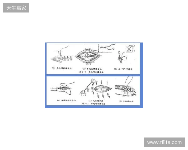 广州豹官方：杨浩眉弓伤口缝合30余针，预计5-7天后拆线